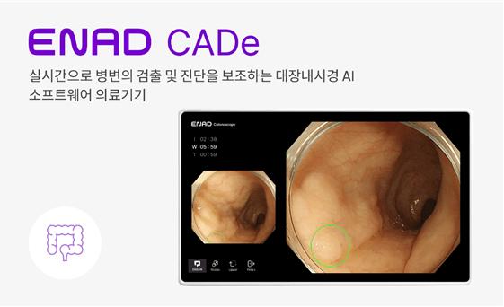 AI 대장내시경